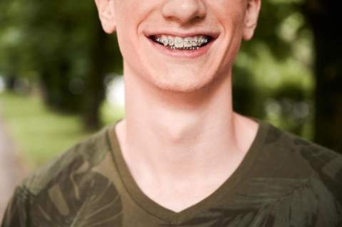 Damon breketai