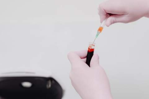 Hematologas
