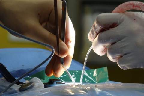 Neurochirurgas