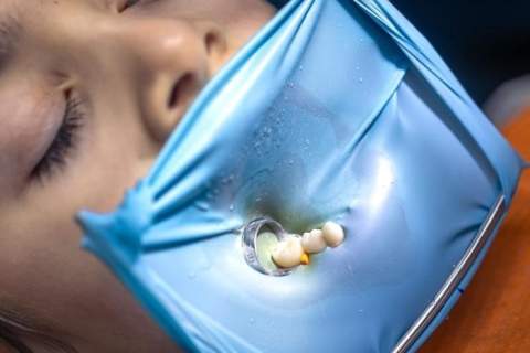 Reguliari higiena aplink implantus