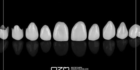 OZO Aesthetic Dentistry and Implantology Clinic